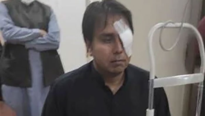 898212 7652335 Gill Eye updates