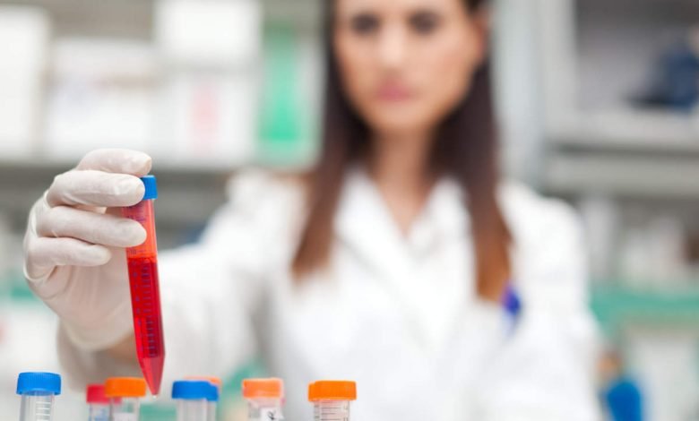 وقت سے پہلے ٹی بی کا سراغ لگانے والا بلڈ ٹیسٹ 1 Premature TB detection blood test