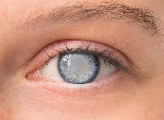 Now there is hope for cataract treatment