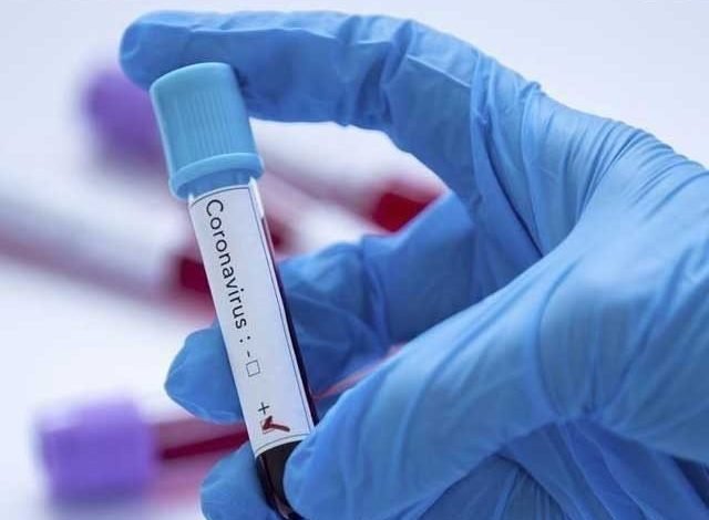 Corona epidemic kills 39 more, reports 930 new cases