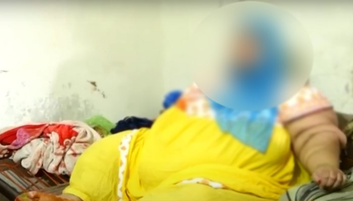 لاہور: 240 کلو وزنی خاتون کا کامیاب آپریشن 1 women