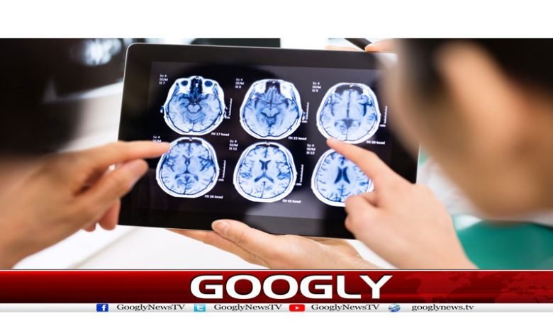 وائرل انفیکشنز کے شکارلوگوں میں نیورو امراض کا انکشاف 1 Neurodegenerative