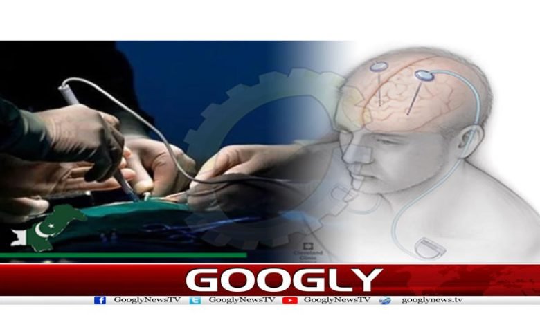 epilepsy