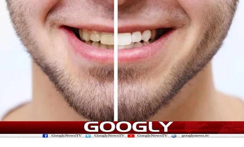 Whiteness of Teeth News in Urdu