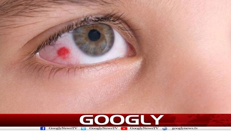 Diabetic Eye News in Urdu