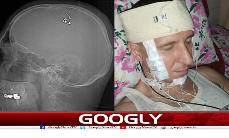 Russian Scientist Surgery on Himself