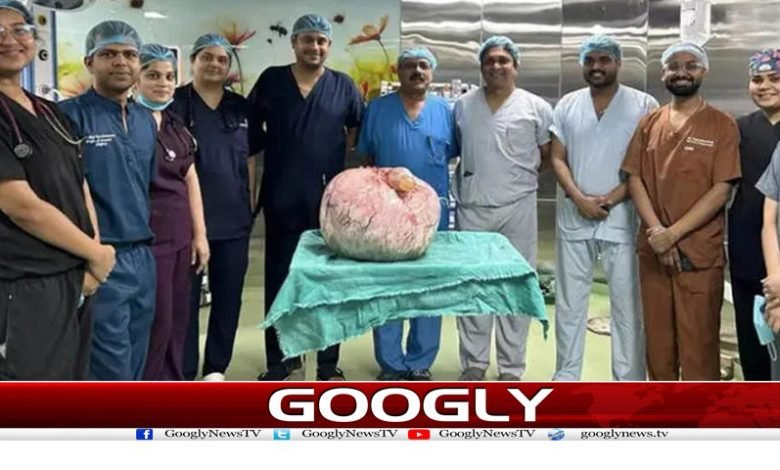 Successful Operation India Tumor Weigh 15 kg
