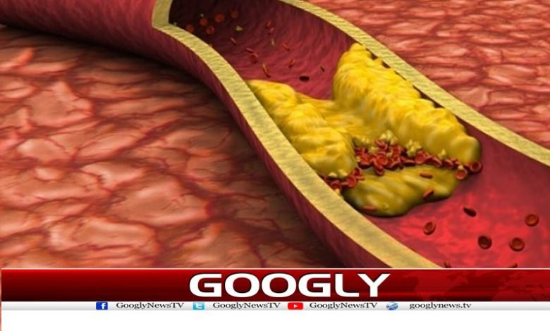 New Cholesterol Lowering Drug News`