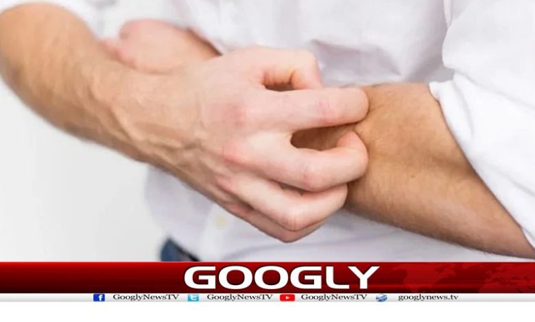 Allergy Medicine Found News Urdu