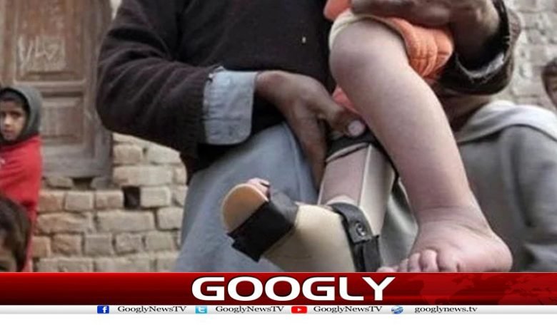 Third Polio Case Report News Urdu