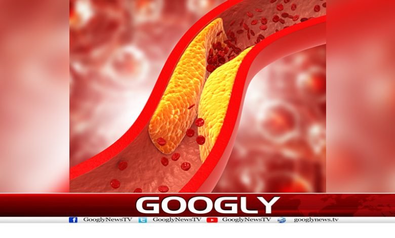 Cholesterol is Not Dangerous News Urdu