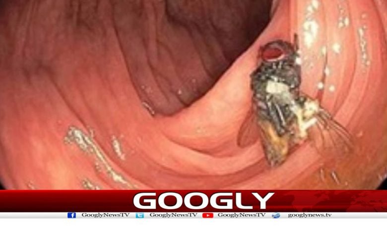 امریکہ میں 63 سالہ شخص کی آنت سے زندہ مکھی برآمد 1 makhi