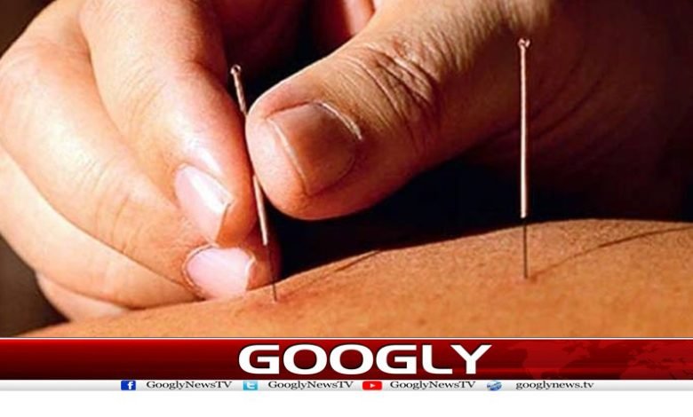 ایکوپنکچر فالج کے خطرات میں کمی لاسکتاہے،ڈاکٹرز 1 Reduce Stroke Risks News Urdu