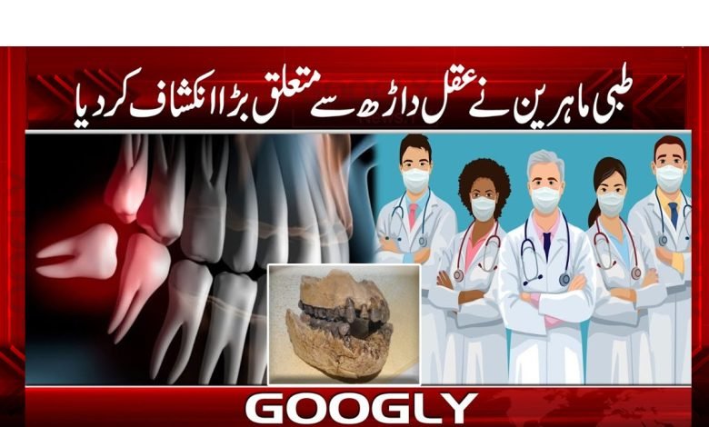 ’’طبی ماہرین کا عقل داڑھ سے متعلق بڑا انکشاف‘‘ 1 Medical Experts Big News in Urdu