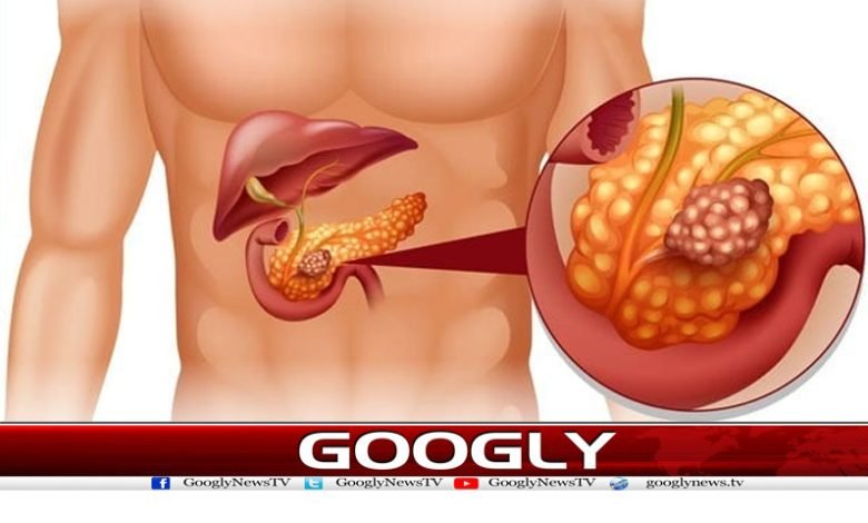 Pancreatic Cancer Latest News in Urdu