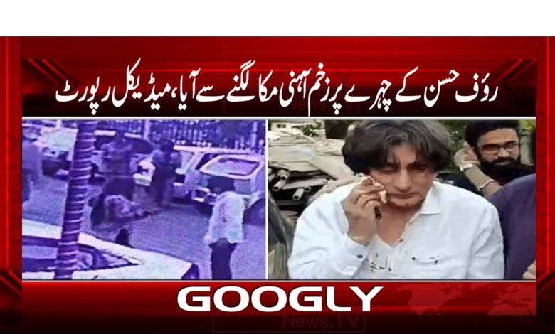 Rauf Hasan injury News in Urdu