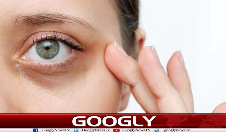 Under the Eyes News in Urdu