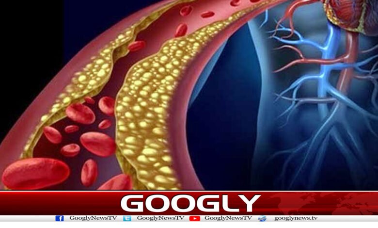 کولیسٹرول پر قابو پانے کے لیے خوراک میں تبدیلی ضروری قرار 1 koss