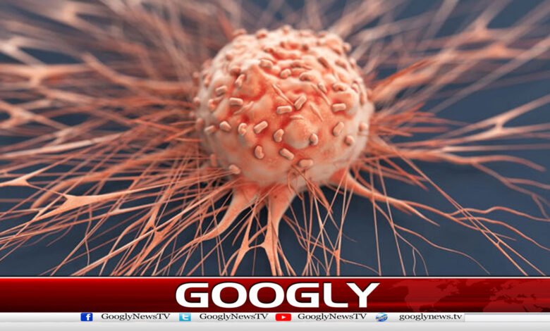 پھیپھڑوں اور آنتوں کےکینسرپھیلنے کی اہم وجہ دریافت 1 پھیپھڑوں اور آنتوں کےکینسرپھیلنے کی اہم وجہ دریافت