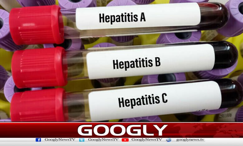 پاکستان میں ہیپاٹائٹس کے مریضوں کی تعداد بڑھ گئی