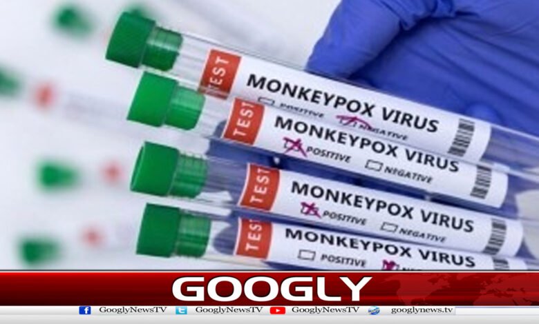 First case report of monkeypox in Khyber Pakhtunkhwa