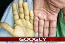 Why does anemia occur in the human body?