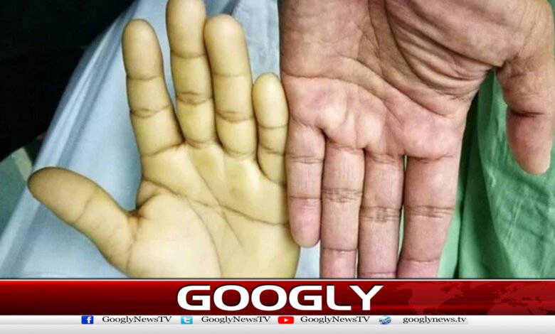 Why does anemia occur in the human body?