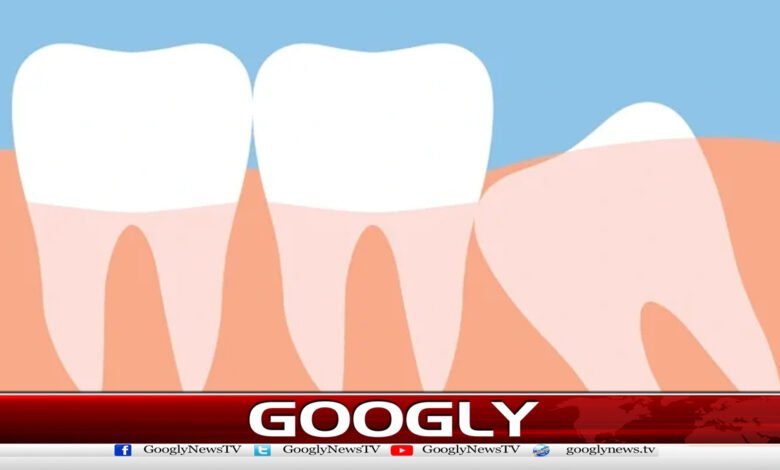 Why do wisdom teeth appear and what is their benefit?