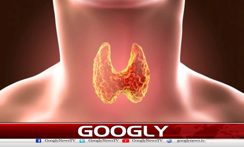 Thyroid hormone causes mental and neurological problems