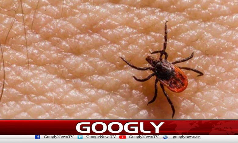 3 Congolese patients die in Sindh and KP