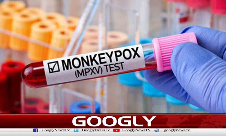 Second case of monkeypox reported in Lahore