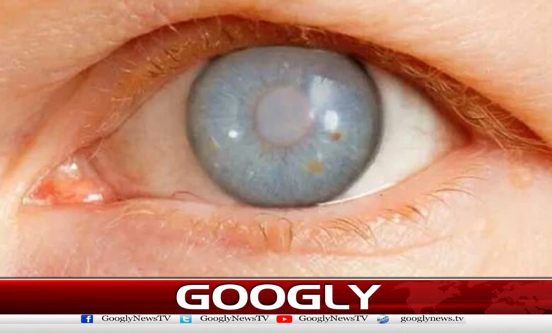 Weight loss drugs cause eye diseases