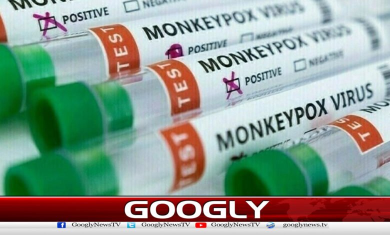 Suspected case of monkeypox reported in Karachi