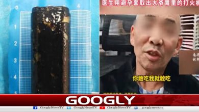 China: Active lighter recovered from citizen's stomach after 30 years