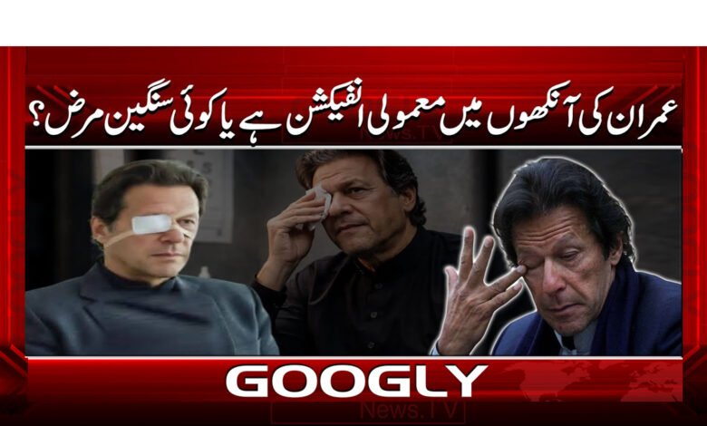 10 عمران کی آنکھوں میں معمولی انفیکشن 1