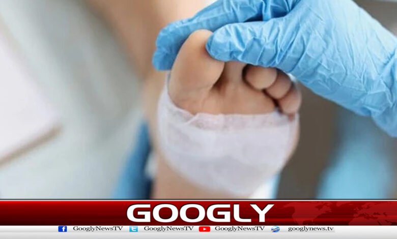 Revolutionary oxygen gel developed for diabetic patients