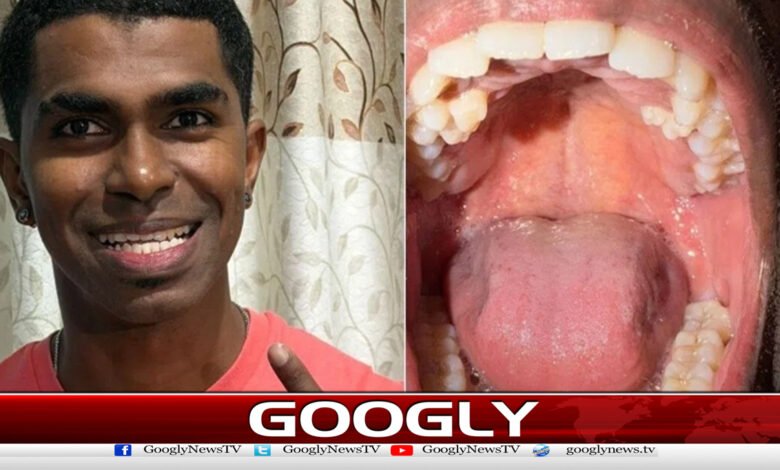 Malaysian man has 42 teeth extracted from his mouth