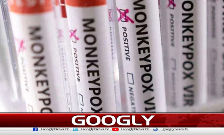 سندھ میں ابتک منکی پاکس سے 9اموات کی تصدیق 1 9 deaths from monkeypox confirmed in Sindh so far
