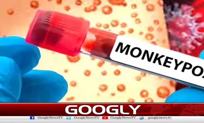لاہور میں 15 سالہ لڑکے میں منکی پاکس کی تصدیق 1 Monkeypox confirmed in 15-year-old boy in Lahore