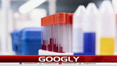 سائنس دانوں نے ٹی بی کیلئےنئی ٹیسٹ ٹیکنالوجی تیار کرلی 2 Scientists develop new test technology for TB