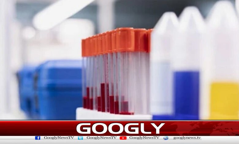 سائنس دانوں نے ٹی بی کیلئےنئی ٹیسٹ ٹیکنالوجی تیار کرلی 1 Scientists develop new test technology for TB