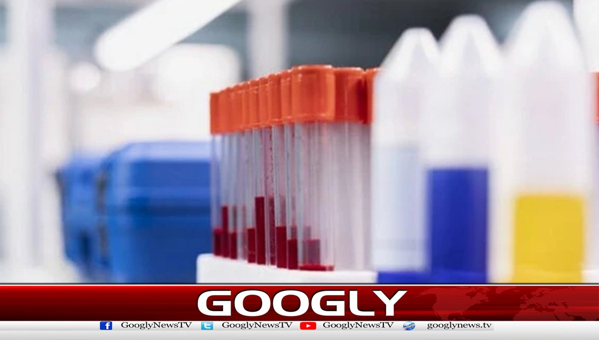 سائنس دانوں نے ٹی بی کیلئےنئی ٹیسٹ ٹیکنالوجی تیار کرلی