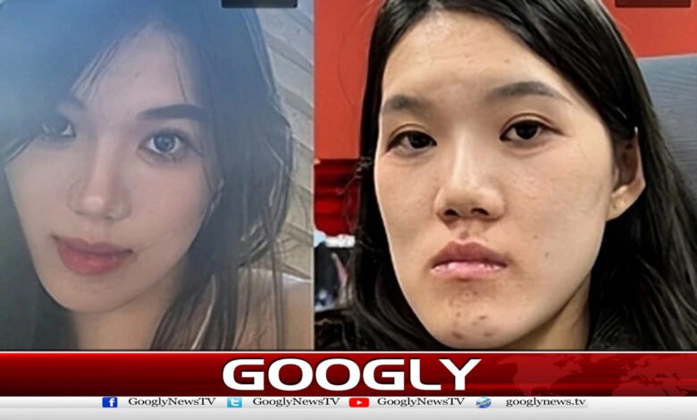 چین میں کاسمیٹک سرجری خاتون کو مہنگی پڑگئی 1 Cosmetic surgery in China cost a woman dearly