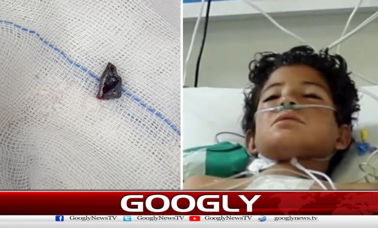 Bullet removed from baby's heart at NICVD Karachi