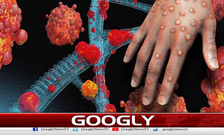 The number of 'monkeypox' cases in Khyber Pakhtunkhwa has reached 4.