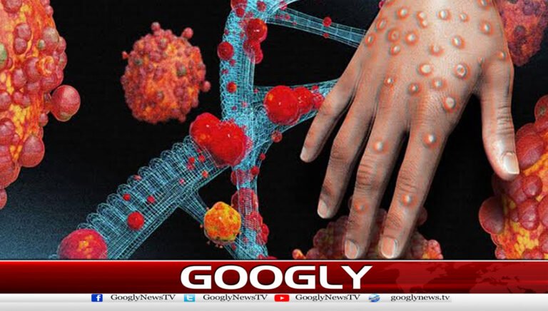 Child suffering from monkeypox dies in Karachi