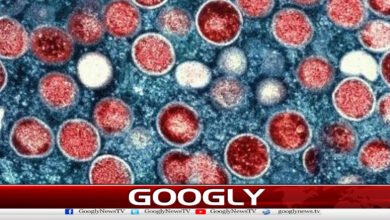 93 cases of mpox confirmed in Sindh this year.